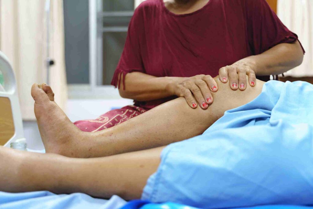 lymphedema symptoms and signs