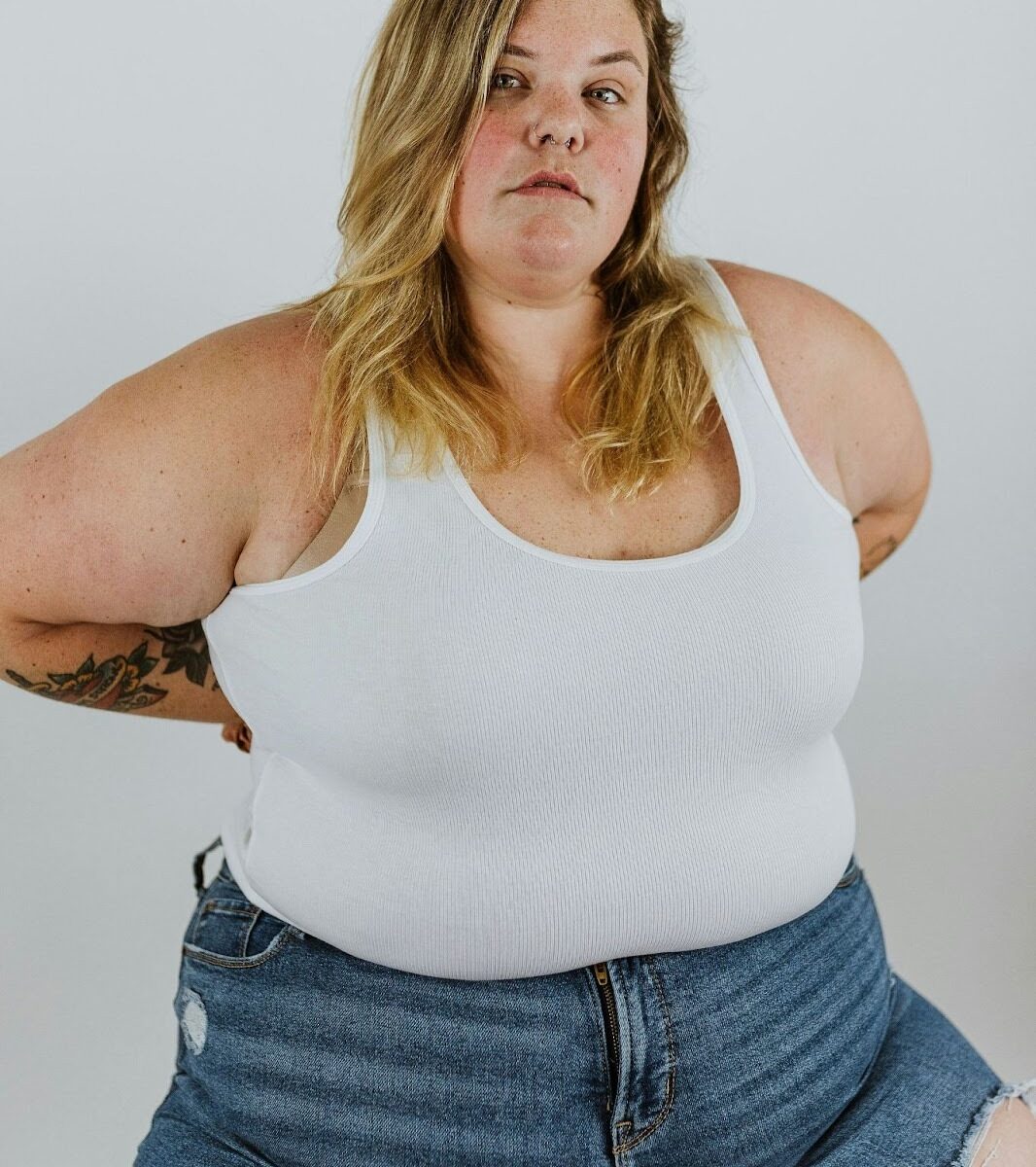 Abdominal and hip enlargement from lymphedema-related fluid and fat accumulation affecting body shape